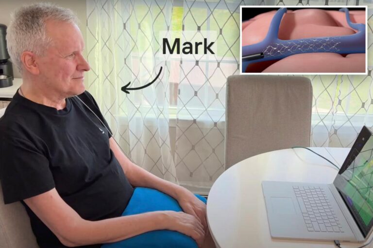 Brain implant lets ALS patient control Amazon's Alexa with thought: 'Gives me back the independence I'm losing'


